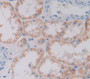 Used in DAB staining on fromalin fixed paraffin- embedded Kidney tissue