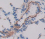 Used in DAB staining on fromalin fixed paraffin- embedded Kidney tissue