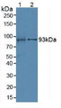 Western Blot; Sample: Lane1: Mouse Kidney Tissue; Lane2: Porcine Liver Tissue.