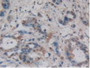 DAB staining on IHC-P; Samples: Human Pancreas Tissue.