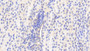 DAB staining on IHC-P; Samples: Human Kidney Tissue;  Primary Ab: 20μg/ml Rabbit Anti-Human UMPS Antibody Second Ab: 2µg/mL HRP-Linked Caprine Anti-Rabbit IgG Polyclonal Antibody 