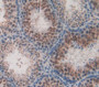 Used in DAB staining on fromalin fixed paraffin- embedded Kidney tissue