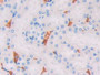 DAB staining on fromalin fixed paraffin- embedded kidney tissue)