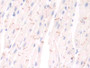 DAB staining on IHC-P; Samples: Mouse Cardiac Muscle Tissue;  Primary Ab: 20µg/ml Rabbit Anti-Mouse