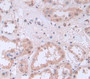 Pim-1 Oncogene (Pim1) Polyclonal Antibody, Cat#CAU24102