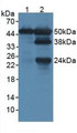 Western Blot; Sample: Lane1: Rat Lung Tissue; Lane2: Rat Spleen Tissue.