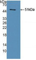 Western Blot; Sample: Recombinant legumain, Human.