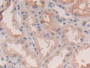 DAB staining on IHC-P; Samples: Human Kidney Tissue; Primary Ab: 30µg/ml Rabbit Anti-Human LGMN Antibody Second Ab: 2µg/mL HRP-Linked Caprine Anti-Rabbit IgG Polyclonal Antibody