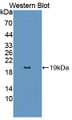 Western Blot; Sample: Recombinant protein.