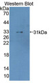 Western Blot; Sample: Recombinant protein.