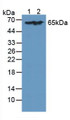 Western Blot; Sample: Lane1: Human Lung Tissue; Lane2: Human Jurkat Cells.