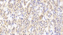 DAB staining on IHC-P; Samples: Human Small intestine Tissue;  Primary Ab: 20μg/ml Rabbit Anti-Human KTN1 Antibody Second Ab: 2µg/mL HRP-Linked Caprine Anti-Rabbit IgG Polyclonal Antibody 