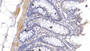 DAB staining on IHC-P; Samples: Human Colon Tissue; Primary Ab: 10µg/ml Rabbit Anti-Human KPNa3 Antibody Second Ab: 2µg/mL HRP-Linked Caprine Anti-Rabbit IgG Polyclonal Antibody