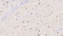 DAB staining on fromalin fixed paraffin- embedded Kidney tissue)