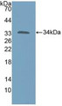 Western Blot; Sample: Recombinant KATNA1, Human.