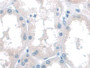 DAB staining on IHC-P; Samples: Human Kidney Tissue; Primary Ab: 10µg/ml Rabbit Anti-Human KATNA1 Antibody Second Ab: 2µg/mL HRP-Linked Caprine Anti-Rabbit IgG Polyclonal Antibody