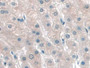 DAB staining on IHC-P; Samples: Human Liver Tissue.