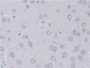 DAB staining on fromalin fixed paraffin- embedded Kidney tissue)