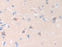 DAB staining on IHC-P; Samples: Human Brain Tissue; Primary Ab: 10µg/ml Rabbit Anti-Human HLTF Antibody Second Ab: 2µg/mL HRP-Linked Caprine Anti-Rabbit IgG Polyclonal Antibody