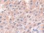 DAB staining on IHC-P; Samples：Human Liver Tissue.