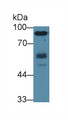 Western Blot; Sample: Human Jurkat cell lysate; Primary Ab: 2µg/ml Rabbit Anti-Human HCK Antibody Second Ab: 0.2µg/mL HRP-Linked Caprine Anti-Rabbit IgG Polyclonal Antibody