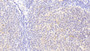 DAB staining on IHC-P; Samples: Human Lymph node Tissue; Primary Ab: 10μg/ml Rabbit Anti-Human HCK Antibody Second Ab: 2µg/mL HRP-Linked Caprine Anti-Rabbit IgG Polyclonal Antibody