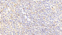 DAB staining on fromalin fixed paraffin- embedded Kidney tissue)