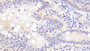 DAB staining on fromalin fixed paraffin- embedded rectum tissue)