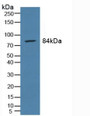 Prostate-specific Membrane Antigen (PMSA) Polyclonal Antibody, CAU24179