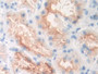 DAB staining on IHC-P; Samples: Human Kidney Tissue; Primary Ab: 10µg/ml Rabbit Anti-Human GCPII Antibody Second Ab: 2µg/mL HRP-Linked Caprine Anti-Rabbit IgG Polyclonal Antibody