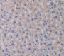 Glucocerebrosidase (Gba) Polyclonal Antibody, Cat#CAU24181