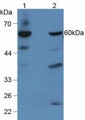 Western Blot; Sample: Lane1: Human Hepg2 Cells; Lane2: Mouse Liver Tissue.