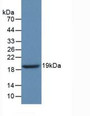 Western Blot; Sample: Recombinant GbA, Human.