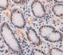 Used in DAB staining on fromalin fixed paraffin- embedded Kidney tissue