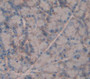 Used in DAB staining on fromalin fixed paraffin- embedded Kidney tissue