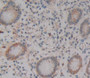 Used in DAB staining on fromalin fixed paraffin- embedded Kidney tissue