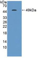 Western Blot; Sample: Recombinant GKN1, Human.