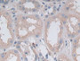 DAB staining on IHC-P; Samples: Human Kidney Tissue.