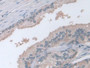 DAB staining on fromalin fixed paraffin- embedded Kidney tissue)