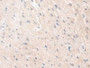 DAB staining on IHC-P; Samples: Rat Heart Tissue.