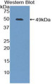 Western Blot; Sample: Recombinant protein.