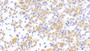 DAB staining on IHC-P; Samples: Mouse Kidney Tissue;  Primary Ab: 10μg/ml Rabbit Anti-Mouse FUR Antibody Second Ab: 2µg/mL HRP-Linked Caprine Anti-Rabbit IgG Polyclonal Antibody 