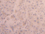 DAB staining on IHC-P; Samples: Human Liver Tissue; Primary Ab: 20µg/ml Rabbit Anti-Human FUR Antibody Second Ab: 2µg/mL HRP-Linked Caprine Anti-Rabbit IgG Polyclonal Antibody
