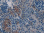 DAB staining on IHC-P; Samples: Mouse Kidney Tissue