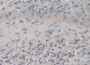 DAB staining on fromalin fixed paraffin-embedded Stomach tissue)