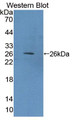 Western Blot; Sample: Recombinant protein.