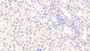 DAB staining on IHC-P; Samples: Human Kidney Tissue;  Primary Ab: 20μg/ml Rabbit Anti-Human FPGT Antibody Second Ab: 2µg/mL HRP-Linked Caprine Anti-Rabbit IgG Polyclonal Antibody 
