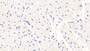 DAB staining on IHC-P; Samples: Human Cardiac Muscle Tissue;  Primary Ab: 20μg/ml Rabbit Anti-Human FLRT2 Antibody Second Ab: 2µg/mL HRP-Linked Caprine Anti-Rabbit IgG Polyclonal Antibody 