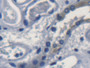 DAB staining on fromalin fixed paraffin- embedded kidney tissue)