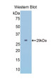 Western Blot; Sample: Recombinant protein.